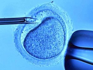 fecondazione in vitro