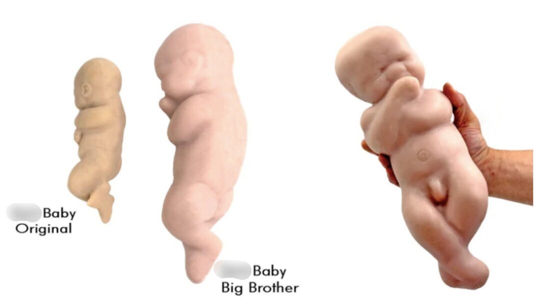 dildo anale feto