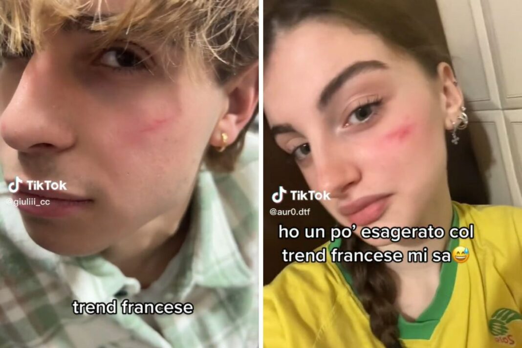 cicatrice francese
